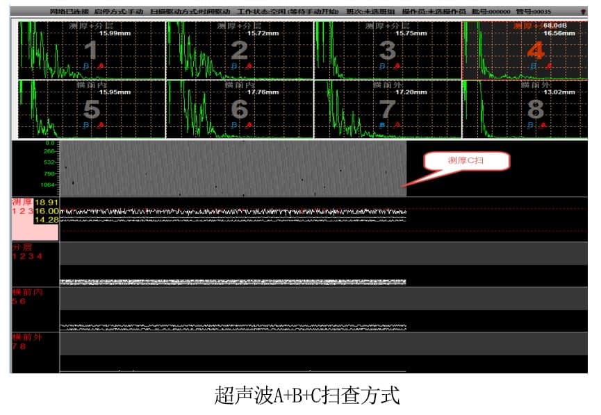 超聲波掃查方式
